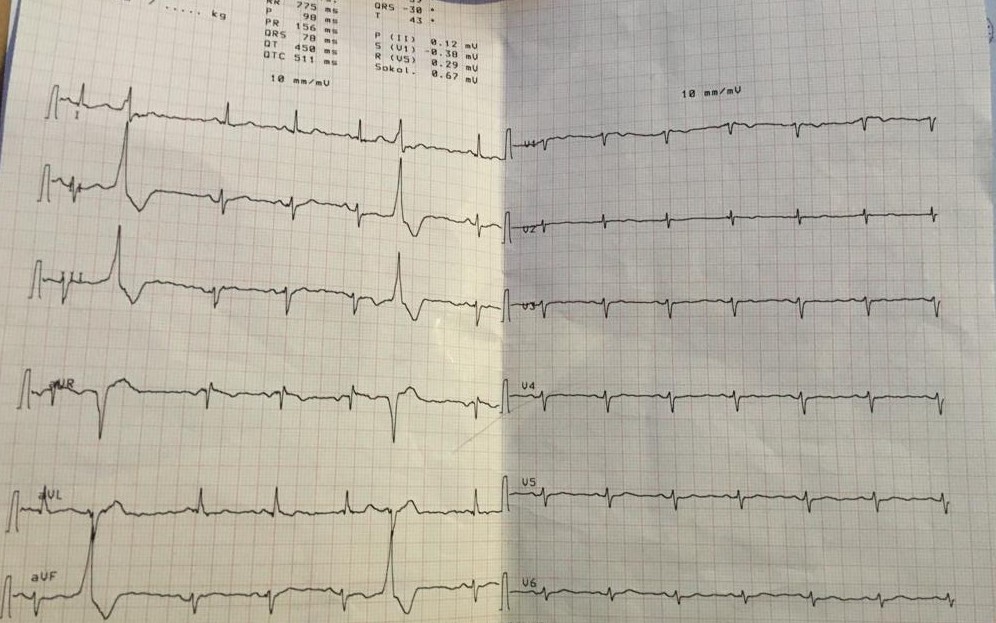 Ankara Evde Elektrokardiyografi (EKG) Hizmeti